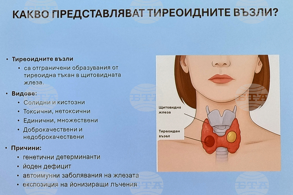 Над 300 000 пациенти са приемали медикаменти за щитовидната жлеза, показват данни за 2024 г.