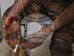 Syria Clashes