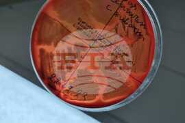 Antarctic Marine Ecosystem Easily Susceptible to Negative Changes By Human Activity